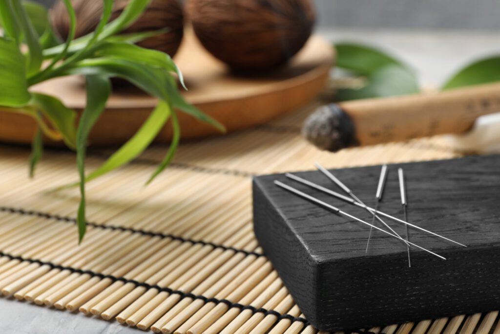 Traditional Acupuncture at PinPoint Health Woodbridge, Ontario.