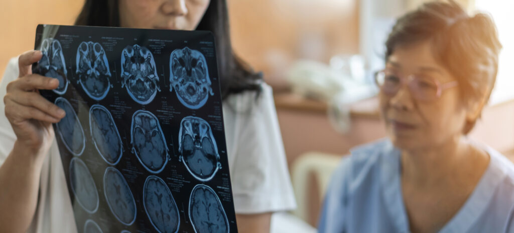 Concussion Management at PinPoint Health Woodbridge, Ontario.